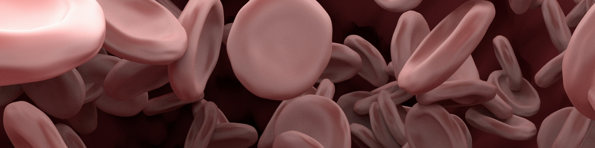 Hereditary Thrombotic Thrombocytopenic Purpura (TTP)